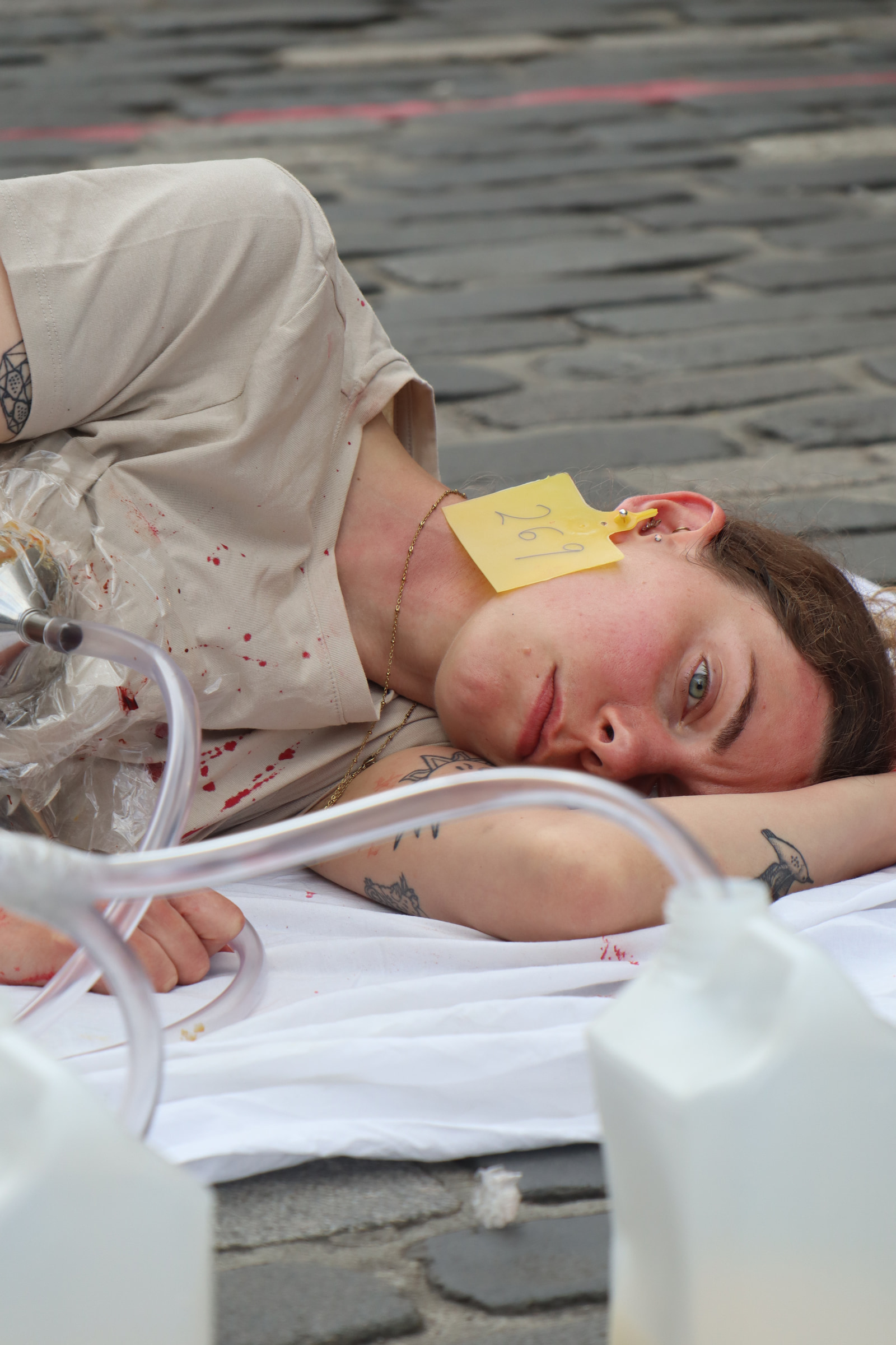 A person lies on a paved surface with medical tubes attached, wearing a yellow sticker on the forehead and showing visible blood on their clothing.
